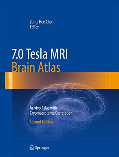 7.0 Tesla MRI Brain Atlas: In-vivo Atlas with Cryomacrotome Correlation von Springer