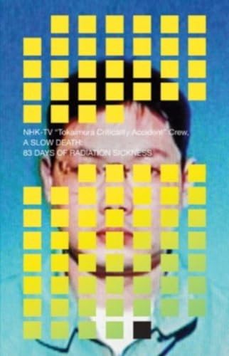 A Slow Death: 83 Days of Radiation Sickness A Slow Death: 83 Days of Radiation Sickness