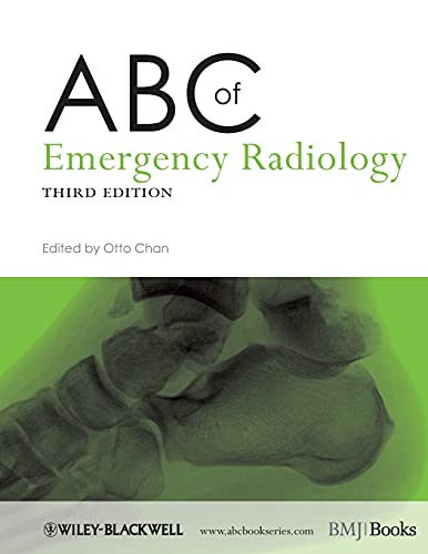 ABC of Emergency Radiology (ABC Series) ABC of Emergency Radiology (ABC Series) von Bmj Publishing Group