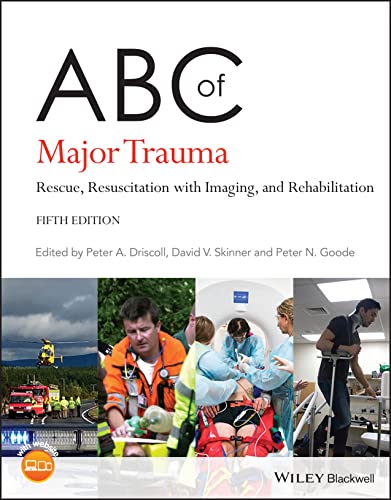 ABC of Major Trauma: Rescue, Resuscitation with Imaging, and Rehabilitation (ABC Series) von Wiley-Blackwell