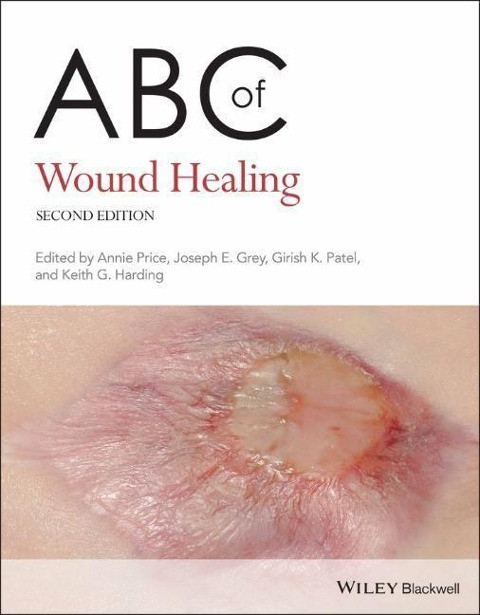ABC of Wound Healing ABC of Wound Healing