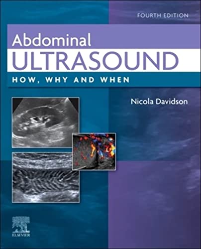 Abdominal Ultrasound: How, Why and When von Elsevier