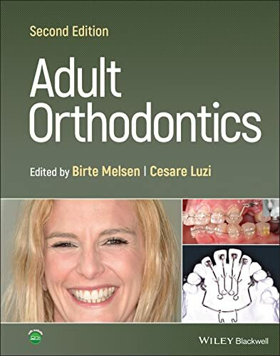 Adult Orthodontics Adult Orthodontics