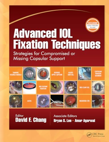 Advanced Iol Fixation Techniques: Strategies for Compromised or Missing Capsular Support von Slack