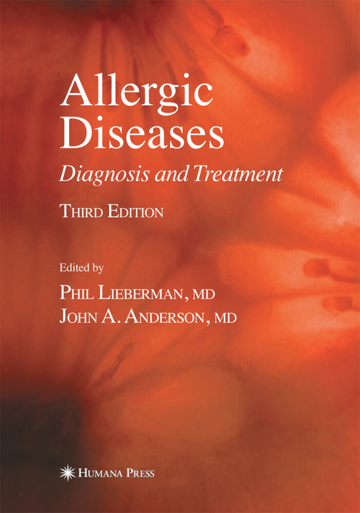 Allergic Diseases von Humana Press