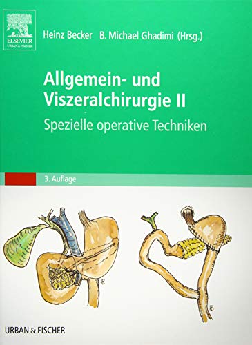Allgemein- und Viszeralchirurgie II - Spezielle operative Techniken- (Becker, Set Allgemein- und Viszeralchirurgie)