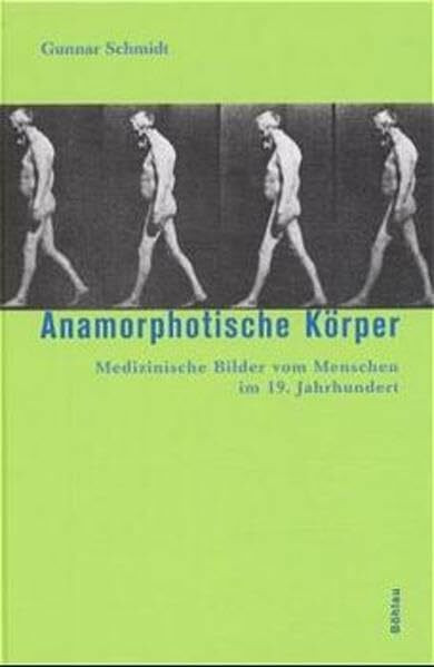 Anamorphotische Körper. Medizinische Bilder vom Menschen im 19. Jahrhundert