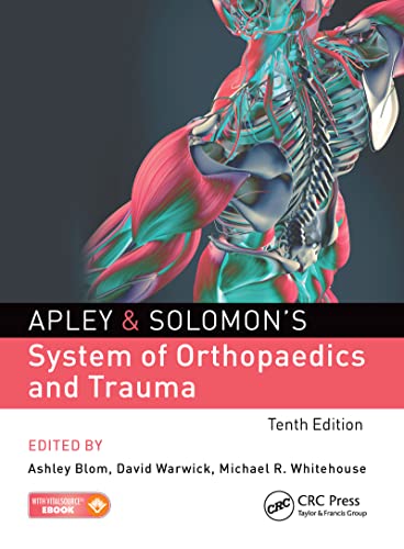 Apley & Solomon's System of Orthopaedics and Trauma von CRC Press