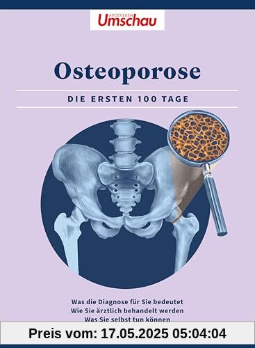 Apotheken Umschau: Osteoporose: Die ersten 100 Tage. Was die Diagnose bedeutet - Wie Sie ärztlich behandelt werden - Was Sie selbst tun können (Die Buchreihe der Apotheken Umschau)