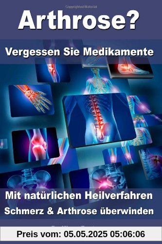 Arthrose? - Vergessen Sie Medikamente - Mit natürlichen Heilverfahren Schmerz und Arthrose überwinden Arthrose? - Vergessen Sie Medikamente - Mit natürlichen Heilverfahren Schmerz und Arthrose überwinden