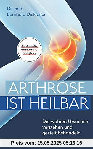 Arthrose ist heilbar: Die wahren Ursachen verstehen und gezielt behandeln