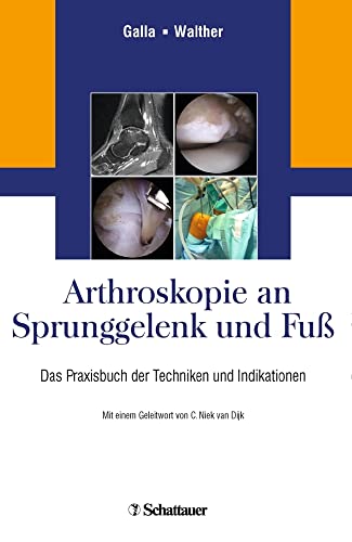 Arthroskopie an Sprunggelenk und Fuß: Das Praxisbuch der Techniken und Indikationen Arthroskopie an Sprunggelenk und Fuß: Das Praxisbuch der Techniken und Indikationen von SCHATTAUER
