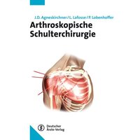 Arthroskopische Schulterchirurgie
