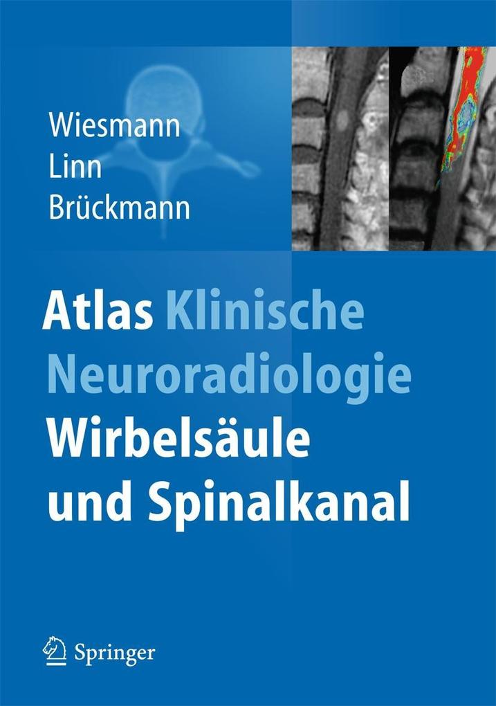 Atlas Klinische Neuroradiologie von Springer Berlin