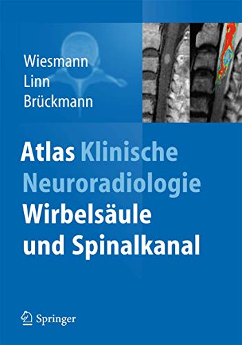 Atlas Klinische Neuroradiologie: Wirbelsäule und Spinalkanal