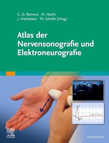 Atlas der Nervensonografie und Elektroneurografie von Urban & Fischer Verlag/Elsevier GmbH