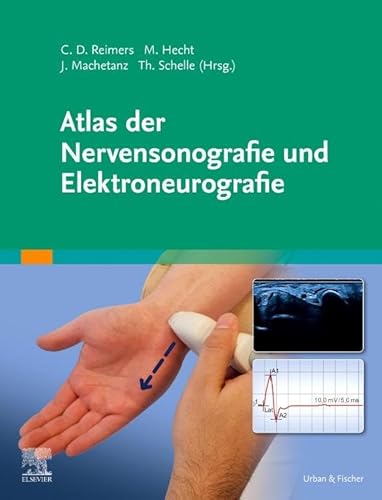 Atlas der Nervensonografie und Elektroneurografie von Urban & Fischer Verlag/Elsevier GmbH