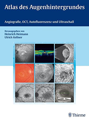 Atlas des Augenhintergrundes: Angiografie, OCT, Autofluoreszenz und Ultraschall