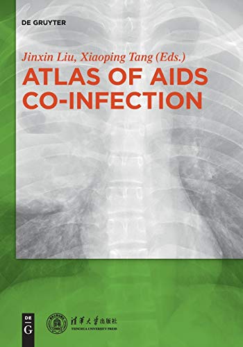 Atlas of AIDS Co-infection