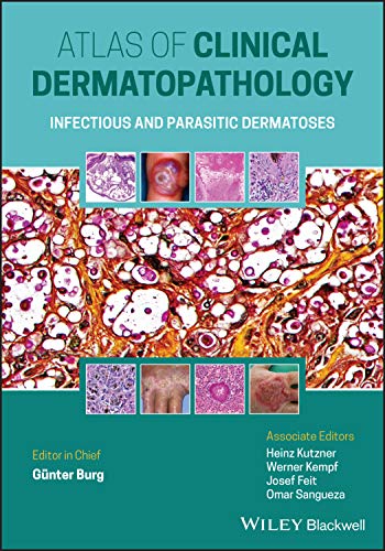 Atlas of Clinical Dermatopathology: Infectious and Parasitic Dermatoses von Wiley-Blackwell