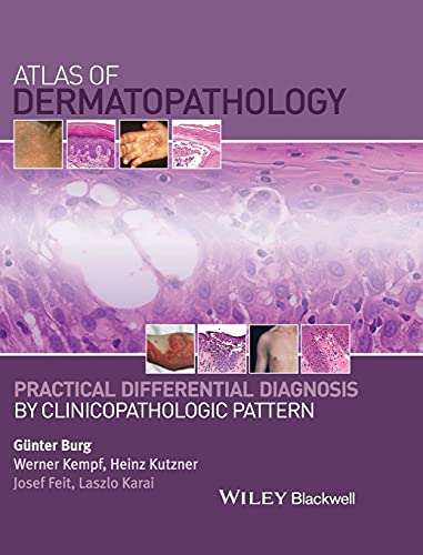 Atlas of Dermatopathology: Practical Differential Diagnosis by Clinicopathologic Pattern von Wiley