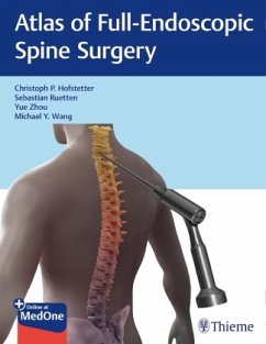 Atlas of Full-Endoscopic Spine Surgery von Thieme Publishers New York / Thieme, Stuttgart