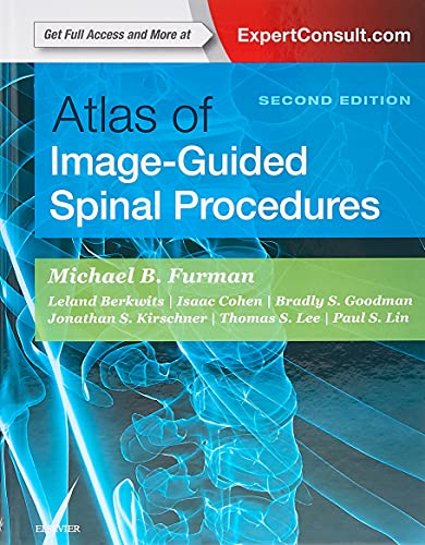 Atlas of Image-Guided Spinal Procedures von Elsevier
