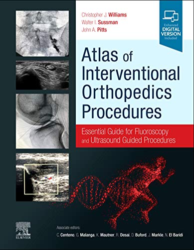 Atlas of Interventional Orthopedics Procedures: Essential Guide for Fluoroscopy and Ultrasound Guided Procedures von Elsevier