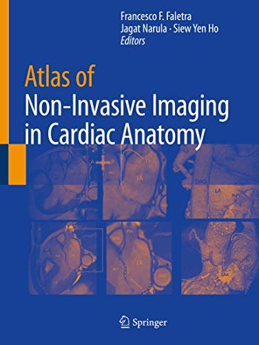 Atlas of Non-Invasive Imaging in Cardiac Anatomy von Springer