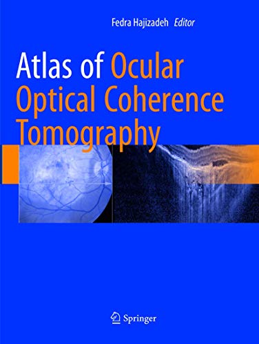 Atlas of Ocular Optical Coherence Tomography von Springer