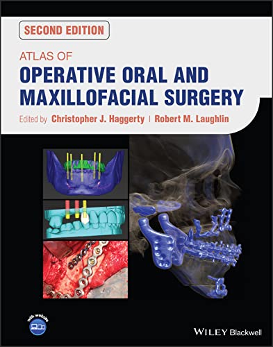 Atlas of Operative Oral and Maxillofacial Surgery von Wiley-Blackwell