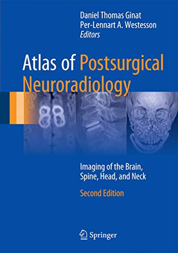 Atlas of Postsurgical Neuroradiology: Imaging of the Brain, Spine, Head, and Neck von Springer