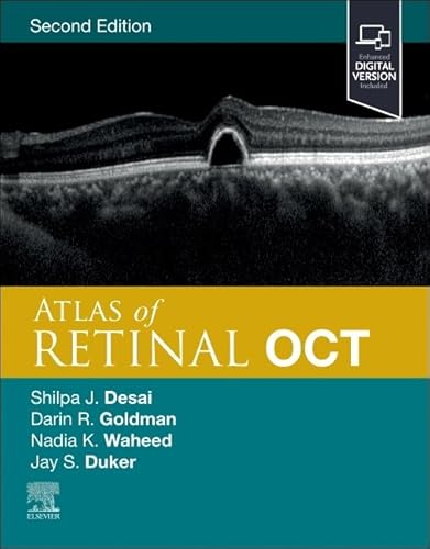 Atlas of Retinal OCT: Optical Coherence Tomography Atlas of Retinal OCT: Optical Coherence Tomography von Elsevier
