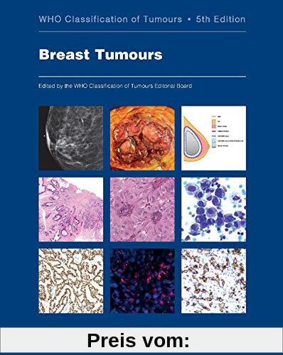 BREAST TUMOURS 5/E: Who Classification of Tumours (World Health Organization Classification of Tumours, Band 2)