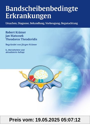 Bandscheibenbedingte Erkrankungen: Ursachen, Diagnose, Behandlung, Vorbeugung, Begutachtung