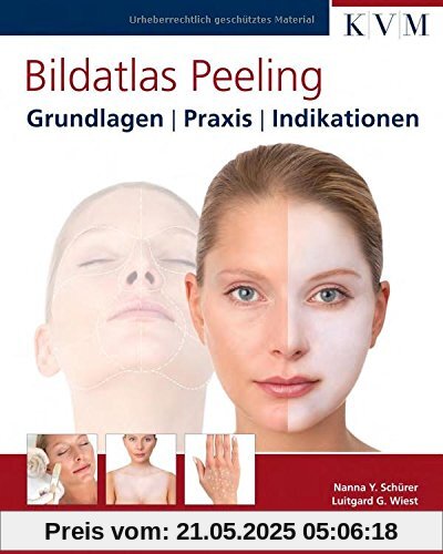 Bildatlas Peeling: Grundlagen | Praxis | Indikationen