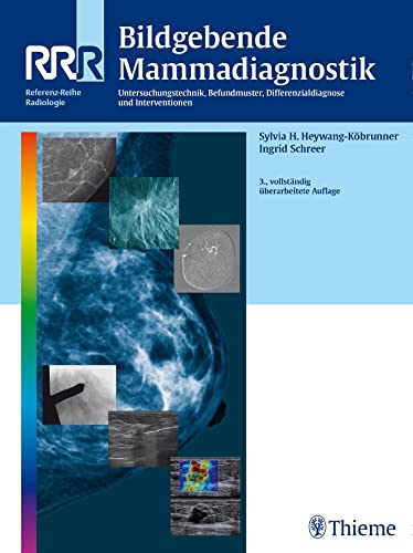 Bildgebende Mammadiagnostik: Untersuchungstechnik, Befundmuster, Differenzialdiagnose und Interventionen von Georg Thieme Verlag