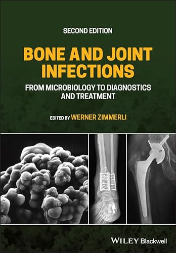Bone and Joint Infections: From Microbiology to Diagnostics and Treatment von Wiley-Blackwell