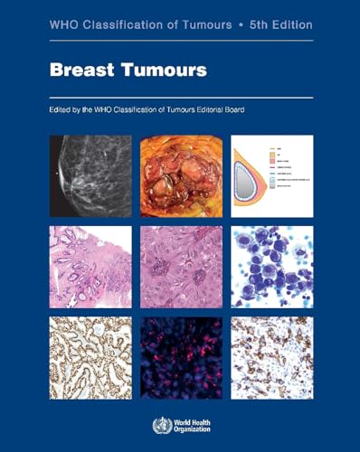 Breast Tumours: Who Classification of Tumours (World Health Organization Classification of Tumours, 2, Band 2)
