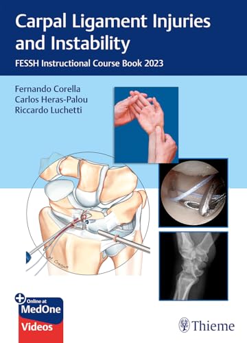 Carpal Ligament Injuries and Instability von Thieme