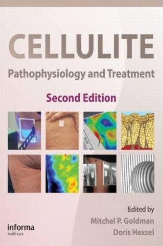 Cellulite: Pathophysiology and Treatment (Basic and Clinical Dermatology, Band 45) von CRC Press Inc