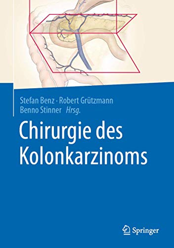 Chirurgie des Kolonkarzinoms von Springer