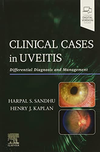 Clinical Cases in Uveitis: Differential Diagnosis and Management von Elsevier