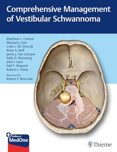 Comprehensive Management of Vestibular Schwannoma: Plus Online at MedOne von Thieme