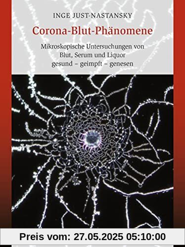 Corona-Blut-Phänomene: Mikroskopische Untersuchungen von Blut, Serum und Liquor gesund – geimpft – genesen