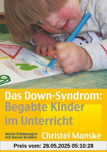 Das Down-Sydrom - Begabte Kinder im Unterricht: Meine Erfahrungen mit diesen Kindern