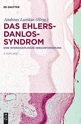 Das Ehlers-Danlos-Syndrom: Eine interdisziplinäre Herausforderung Das Ehlers-Danlos-Syndrom: Eine interdisziplinäre Herausforderung