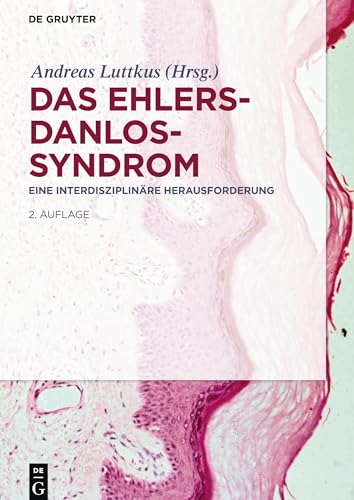 Das Ehlers-Danlos-Syndrom: Eine interdisziplinäre Herausforderung