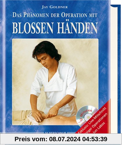 Das Phänomen der Operation mit blossen Händen, m. DVD
