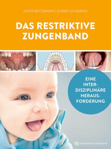 Das restriktive Zungenband: Eine interdisziplinäre Herausforderung von Quintessenz Verlag